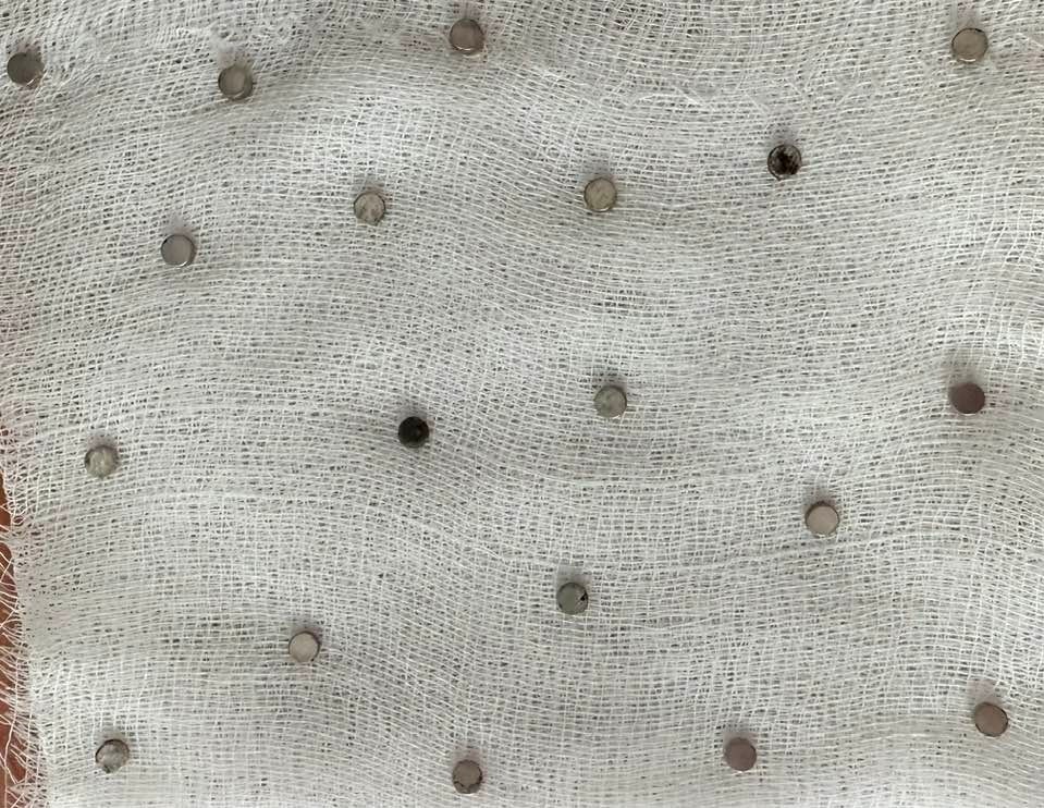 Boğazından 19 adet mıknatıs çıkartıldı - 2