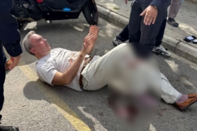 Alanya'da boşanma aşamasındaki eşini bıçakladı