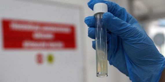 Dünyanın en ölümcül bulaşıcı hastalığı geçen yıl 1,23 milyon can aldı