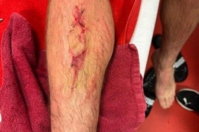 GALATASARAY HABERİ: İşte Sallai'nin son durumu!