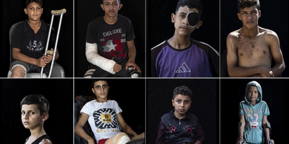 Gazze’de 5 bini aşkın çocuk ampute edildi