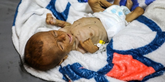 Gazze’deki hasta çocuklar, umutsuzca yurt dışında tedavi olacakları günü bekliyor