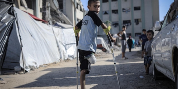 Gazze’deki Sağlık Bakanlığı: 6 bin ampute vakası acil ve uzun süreli rehabilitasyona ihtiyaç duyuyor