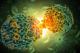 İleri Evre Akciğer Kanserinde Yaşam Süresini Artıran Yöntem!