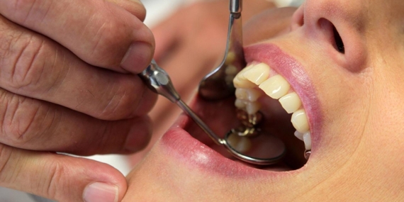 İlerleyen diş çürüğü sistemik hastalıkları tetikleyebilir