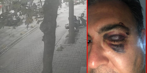 Kedi besleyen iş insanına “Yolu kapattın” dayağı