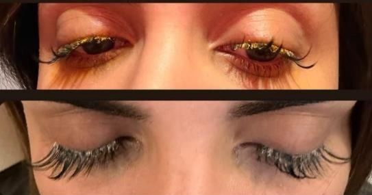 Kirpiklerini yaptırmaya gitti, gözüne yapıştırıcı kaçtı! “Gözlerim göremez hale geldi”