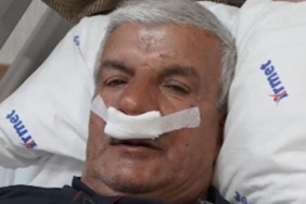 Burnundan 100 gramlık taş çıkarıldı