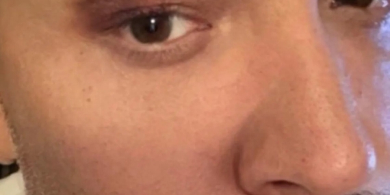 Cenk Eren sahnede talihsiz kaza geçirdi