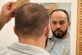 Doğal tatlandırıcı, saç dökülmesi tedavisinin etkinliğini artırıyor olabilir