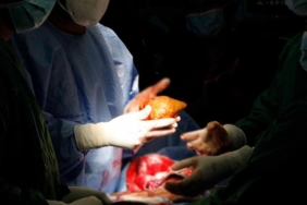 Kuduzlu böbrek nakli yapıldı, hayatını kaybetti