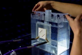 Türk bilim insanları başardı: Bakteri dışarı 'haber verecek'