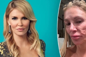 Ünlü televizyon yıldızının yüzü tanınmaz hale geldi! Teşhis konulana kadar 130 bin dolar harcadı