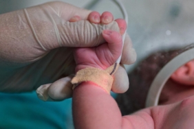 Yenidoğan bebeklerin tanı ve tedavileri yapay zekayla belirlenecek