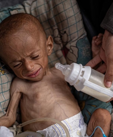 DSÖ: Gazze'de 4 bini çocuk 18 bin 500'den fazla hasta tıbbı tahliyeye ihtiyaç duyuyor