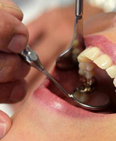 İlerleyen diş çürüğü sistemik hastalıkları tetikleyebilir