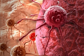 Uzman İsimden Kritik Kanser Uyarısı