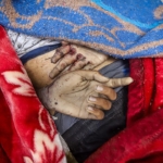 Lancet: Gazze'de can kaybı bildirilenden çok daha yüksek