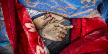 Lancet: Gazze'de can kaybı bildirilenden çok daha yüksek