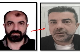 Estetikle yüzünü değiştiren cinayet zanlısı yakalandı