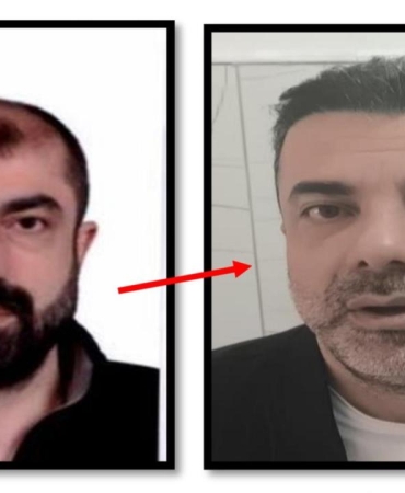 Estetikle yüzünü değiştiren cinayet zanlısı yakalandı