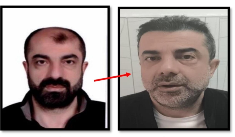 Estetikle yüzünü değiştiren cinayet zanlısı yakalandı