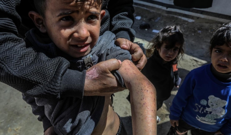 Filistin Sağlık Bakanlığından Gazze'de salgın hastalık uyarısı