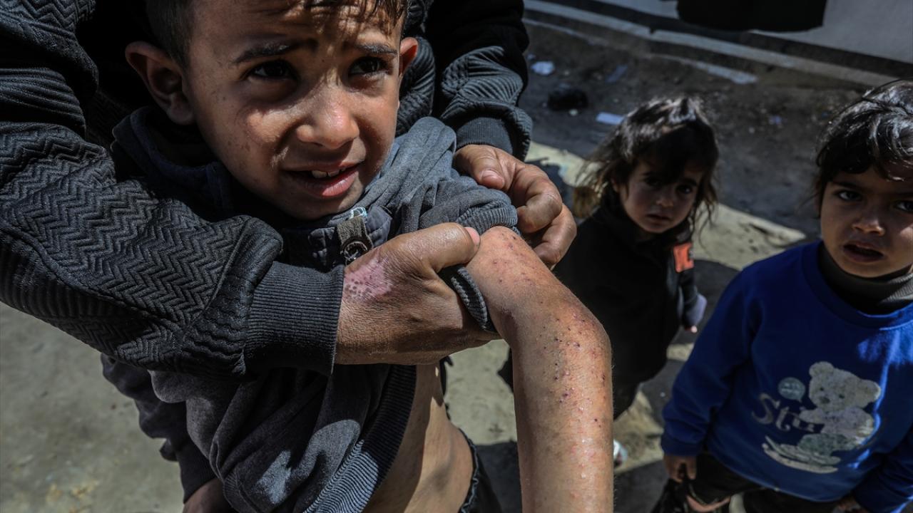 Filistin Sağlık Bakanlığından Gazze'de salgın hastalık uyarısı