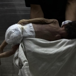 Gazze'de savaşın gölgesinde bebek ölümleri ve doğum kusurları artıyor