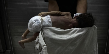 Gazze'de savaşın gölgesinde bebek ölümleri ve doğum kusurları artıyor