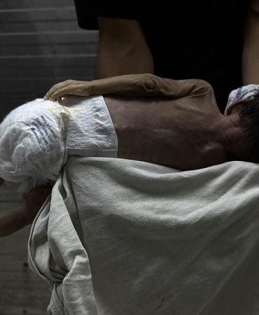 Gazze'de savaşın gölgesinde bebek ölümleri ve doğum kusurları artıyor