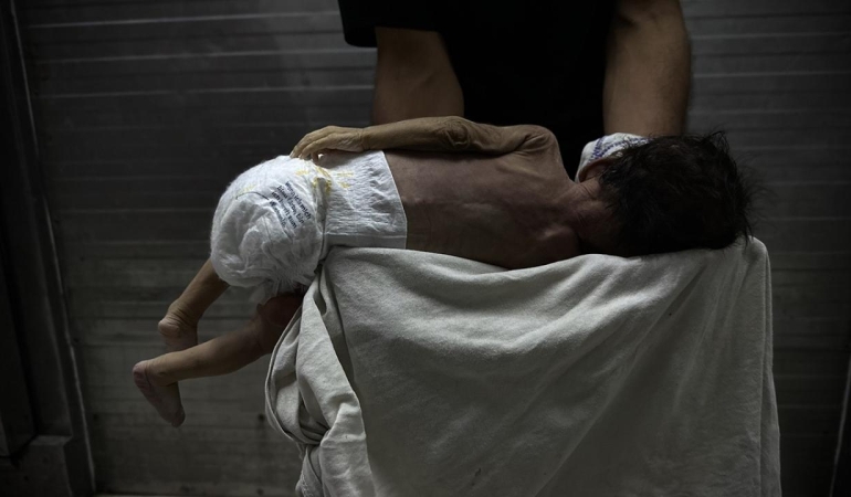 Gazze'de savaşın gölgesinde bebek ölümleri ve doğum kusurları artıyor